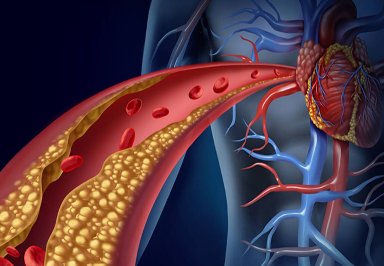 Descubre Las 2 Frutas Que Ayudan A Limpiar Arterias Y Venas De Forma