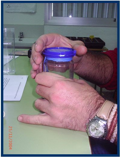 Figura 8.- Bote de vidrio y globo para barómetro.