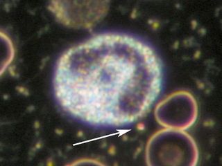 Las nanobacterias en las nubes pueden actuar como núcleos de condensación