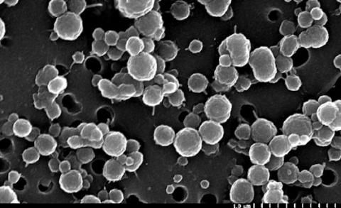 Análisis de micrografía electrónica de células bacterianas muy pequeñas y numerosas Análisis de micrografía electrónica de células bacterianas muy pequeñas y numerosas que habitan en canales de salmuera helada en el lago Vida de la Antártida, que se encuentra en el Valle Victoria, uno de los más septentrional de los valles secos antárticos. Crédito: Christian H. Fritsen, Desert Research Institute