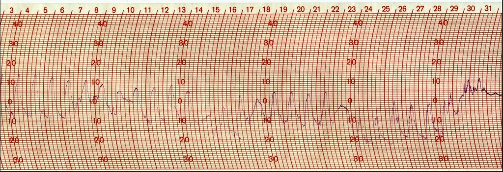 Figura 6. Curva real de la temperatura entre los días 3 y 31 de diciembre de 2001 Figura 6. Curva real de la temperatura entre los días 3 y 31 de diciembre de 2001