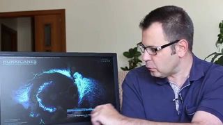 Trayectorias ciclónicas tropicales