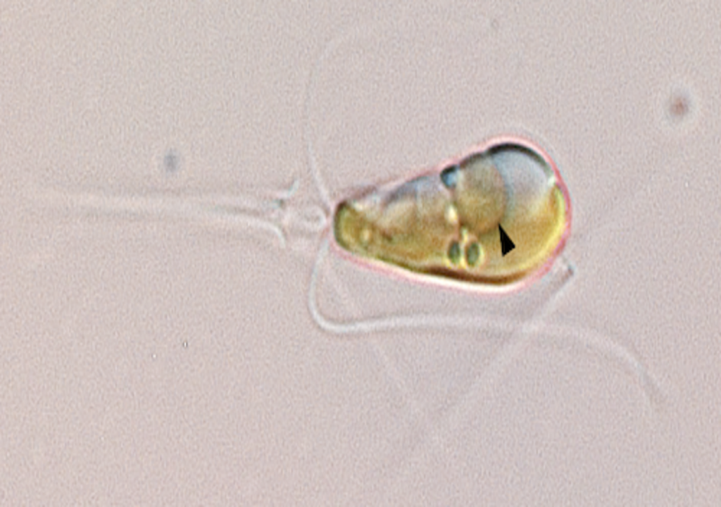 B. bigelowii algal cell