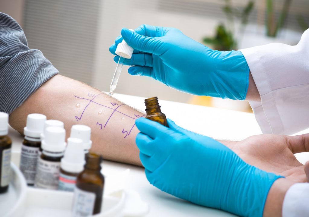 prueba de alergia vacunas