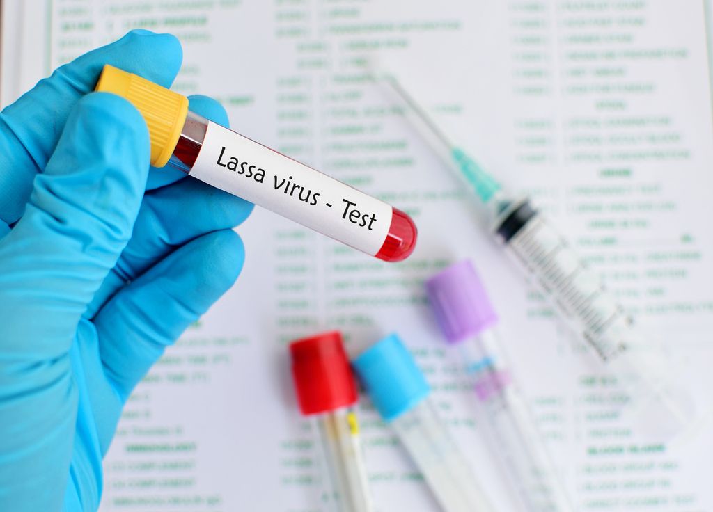 Fièvre de Lassa virus diagnostic maladie