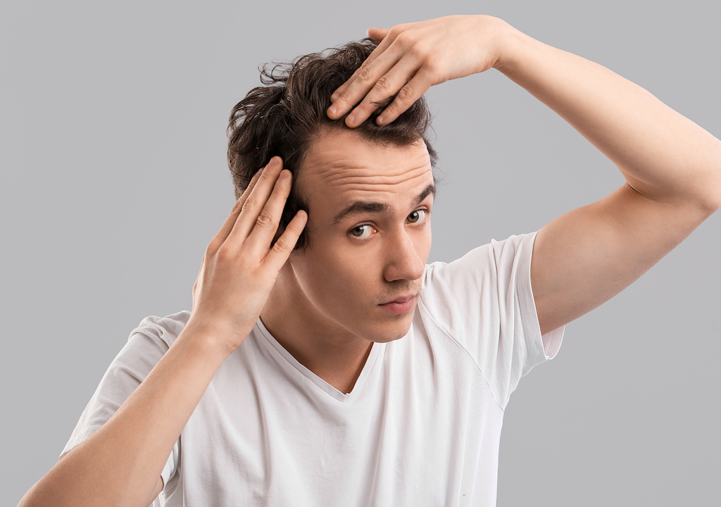 Junger Mann mit Haarausfall: Ein weit verbreitetes Problem, das viele Menschen betrifft und zunehmend das Interesse an ganzheitlichen Behandlungsmethoden wie PMT weckt.