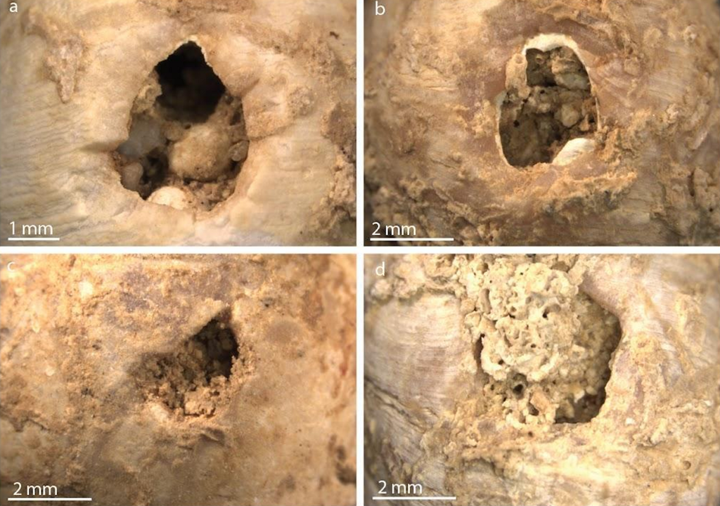 Mikroskopische Ansichten der an L. obtusata beobachteten Veränderungen, hier: durch Druck entstandene Perforationen. Mikroskopische Ansichten der an L. obtusata beobachteten Veränderungen, hier: durch Druck entstandene Perforationen.