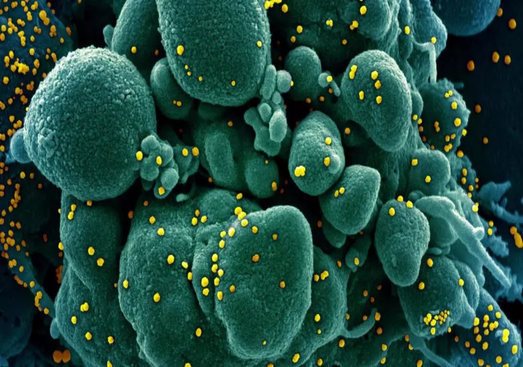 Pandemia Pandemia