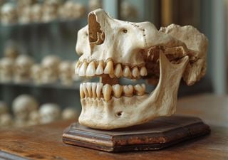 Arqueólogos encuentran unos dientes de hace 4,000 años, estos ¿tenían caries?