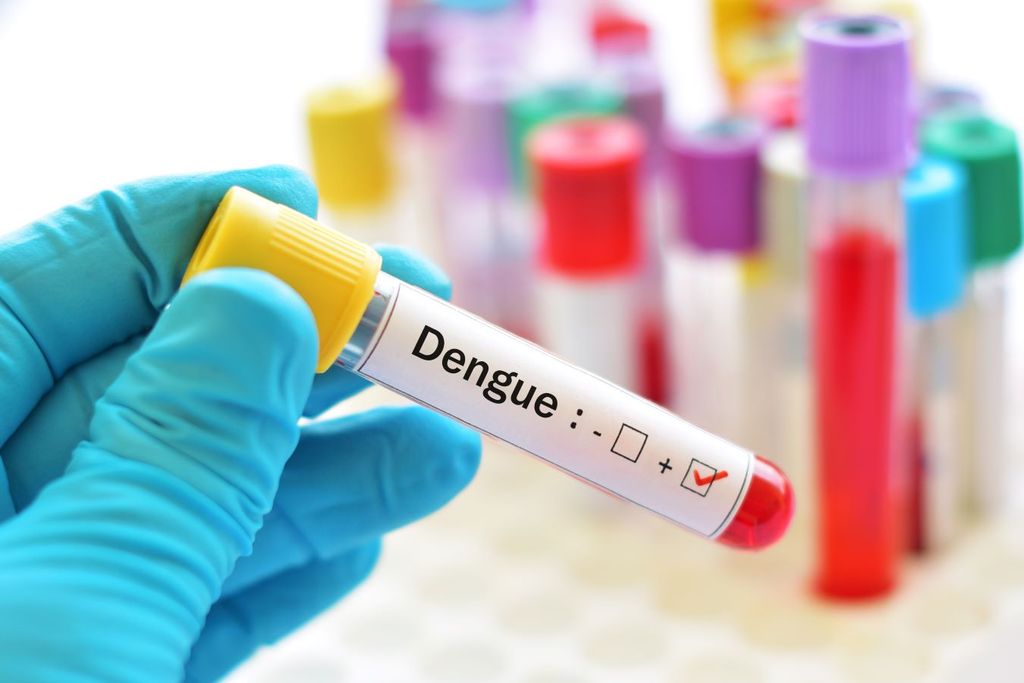 Para identificar el virus del dengue es necesario una prueba de sangre