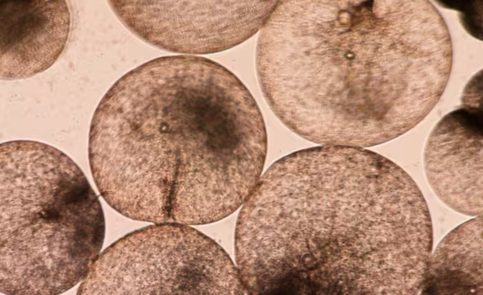 Células de algas pardas con forma de nenúfar, ampliadas bajo un microscopio. Células de Noctiluca vistas al microscopio. Foto: Joaquim Goes