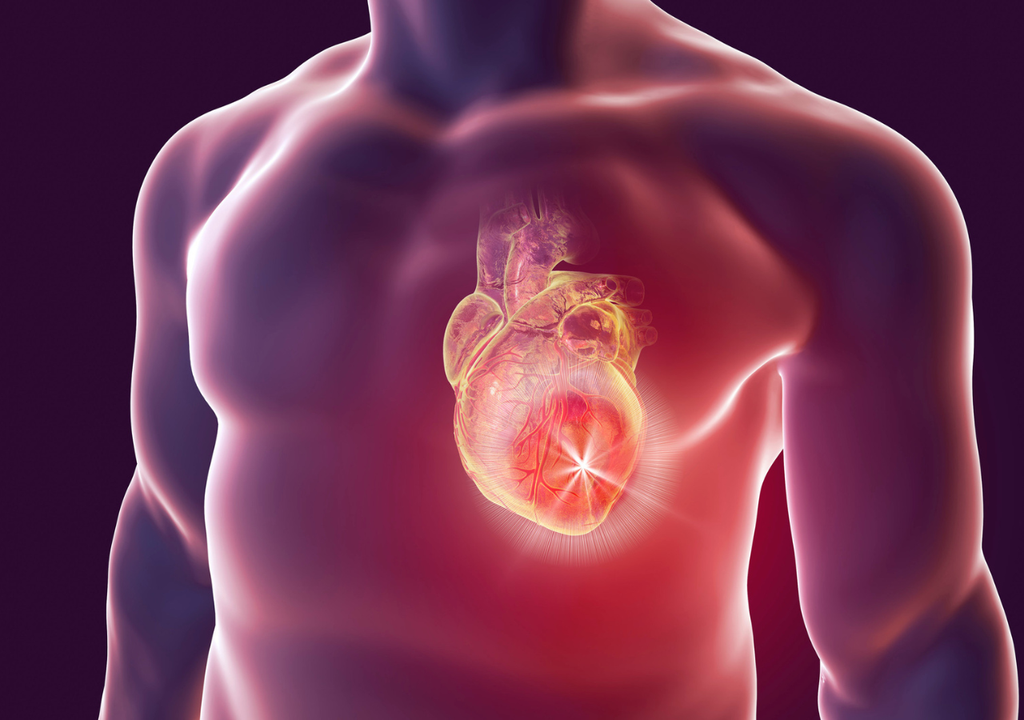 Parche del MIT tras un infarto al corazón, Meteored, Chile