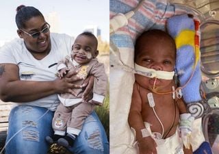 Bebê prematuro quebra recordes e expõe crise de saúde nos EUA
