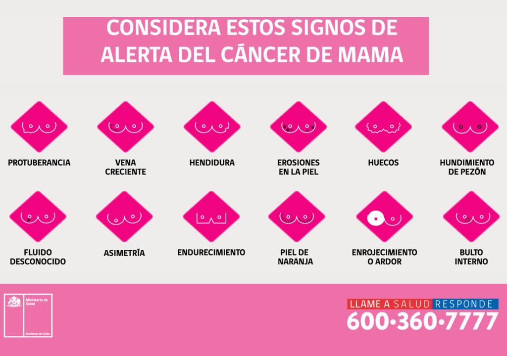 Signos de alerta de cáncer de mama que pueden ser notorios con una examen visual y palpación. Signos de alerta de cáncer de mama que pueden ser notorios con una examen visual y palpación.