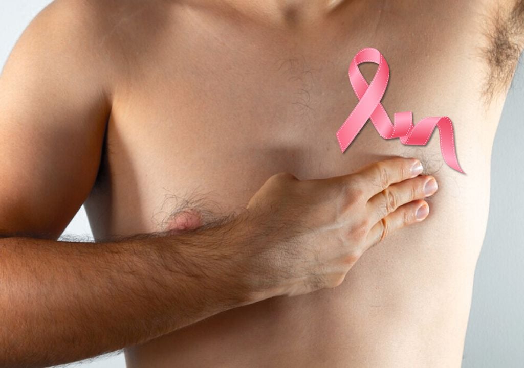 homens com câncer de mama