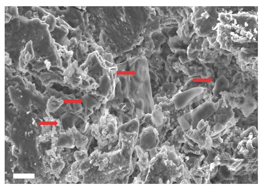 Imágenes de SEM en modo de electrones secundarios (SES), que ilustran la morfología superficial de posibles estructuras similares a eritrocitos (flechas rojas) en el dentario patológico de Telmatosaurus transsylvanicus . Imágenes de SEM en modo de electrones secundarios (SES), que ilustran la morfología superficial de posibles estructuras similares a eritrocitos (flechas rojas) en el dentario patológico de Telmatosaurus transsylvanicus .