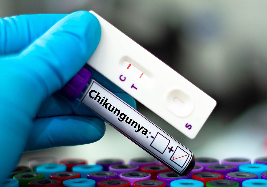 Virus Chikungunya