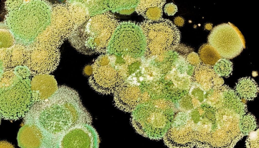Le spore della muffa osservate al microscopio