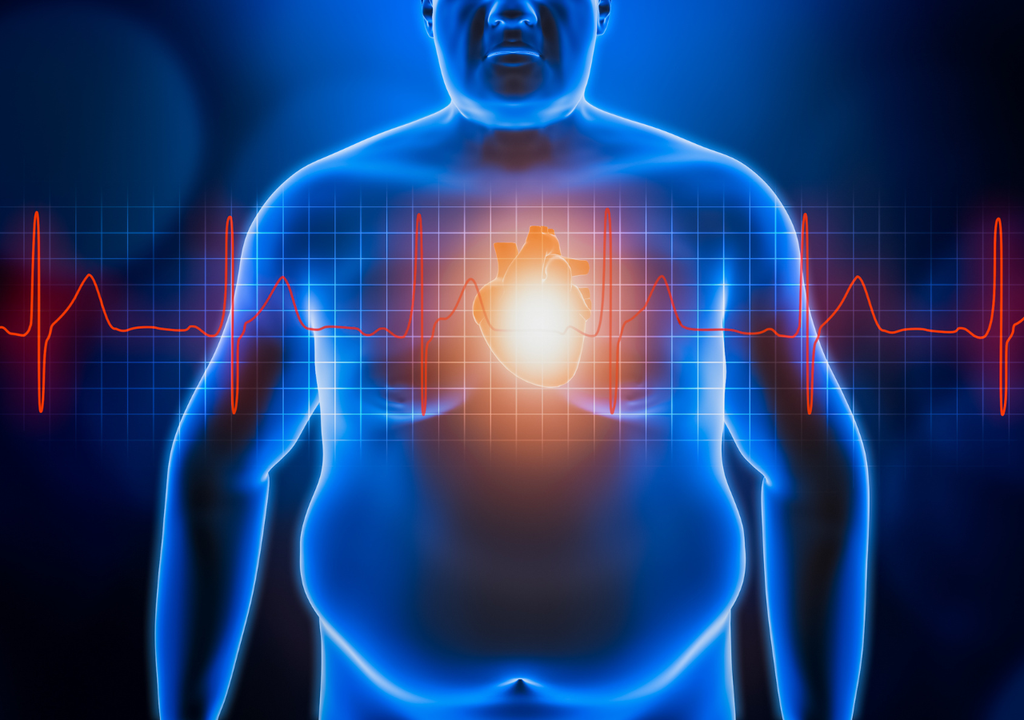 La obesidad clínica es una enfermedad sistémica crónica caracterizada por alteraciones en la función de los tejidos, órganos, el individuo entero o una combinación de ambos, debido al exceso de adiposidad. La obesidad clínica es una enfermedad sistémica crónica caracterizada por alteraciones en la función de los tejidos, órganos, el individuo entero o una combinación de ambos, debido al exceso de adiposidad.