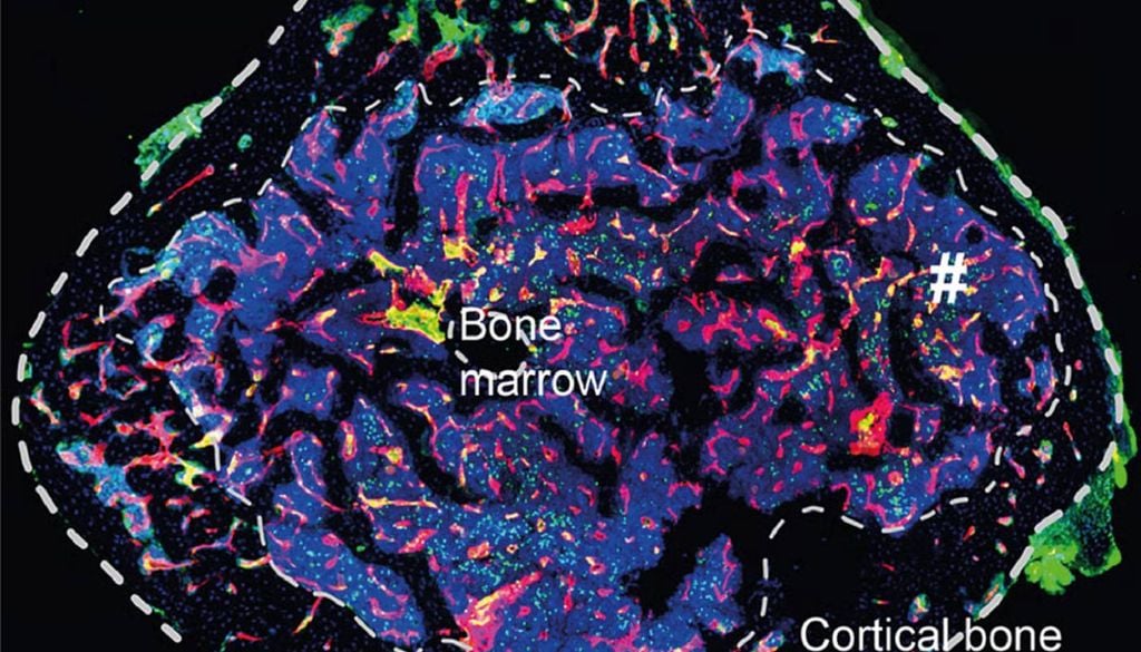 Corte transversal de tecido ósseo obtido por microscopia de fluorescência, mostrando a separação entre o osso cortical (camada exterior) e a medula óssea, onde a equipa mapeou os vasos linfáticos. Imagem: MIA-Portugal