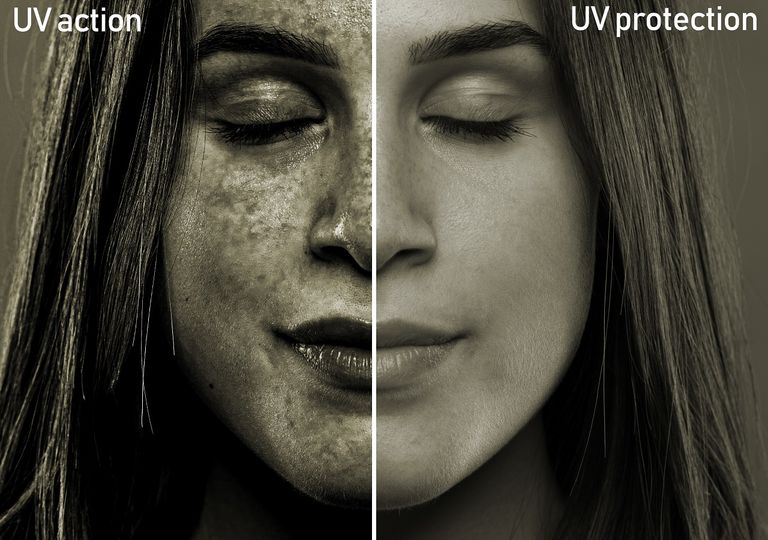 Efectos de la radiación solar ultravioleta en una mujer Efectos de la radiación solar ultravioleta en una mujer