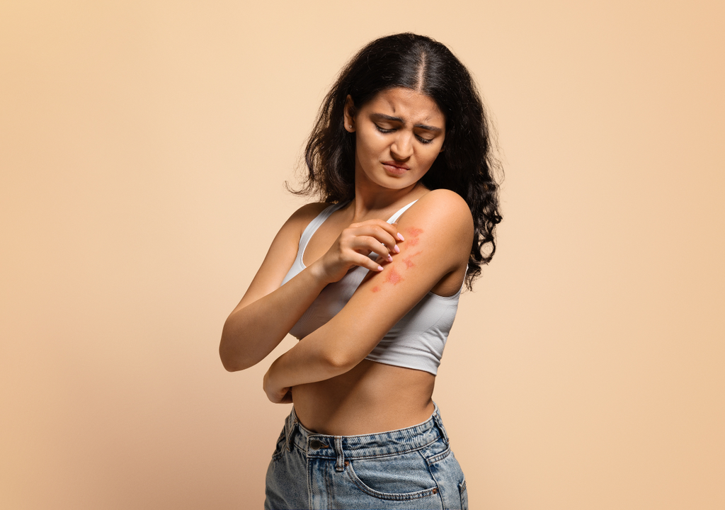 niña con dermatitis atópica niña con dermatitis atópica