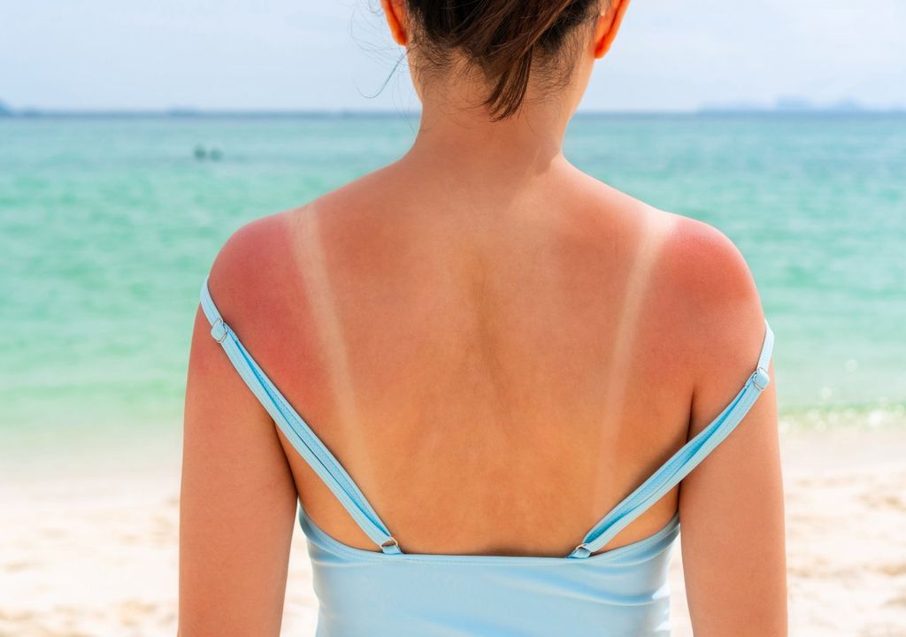 rayos uv rayos uv
