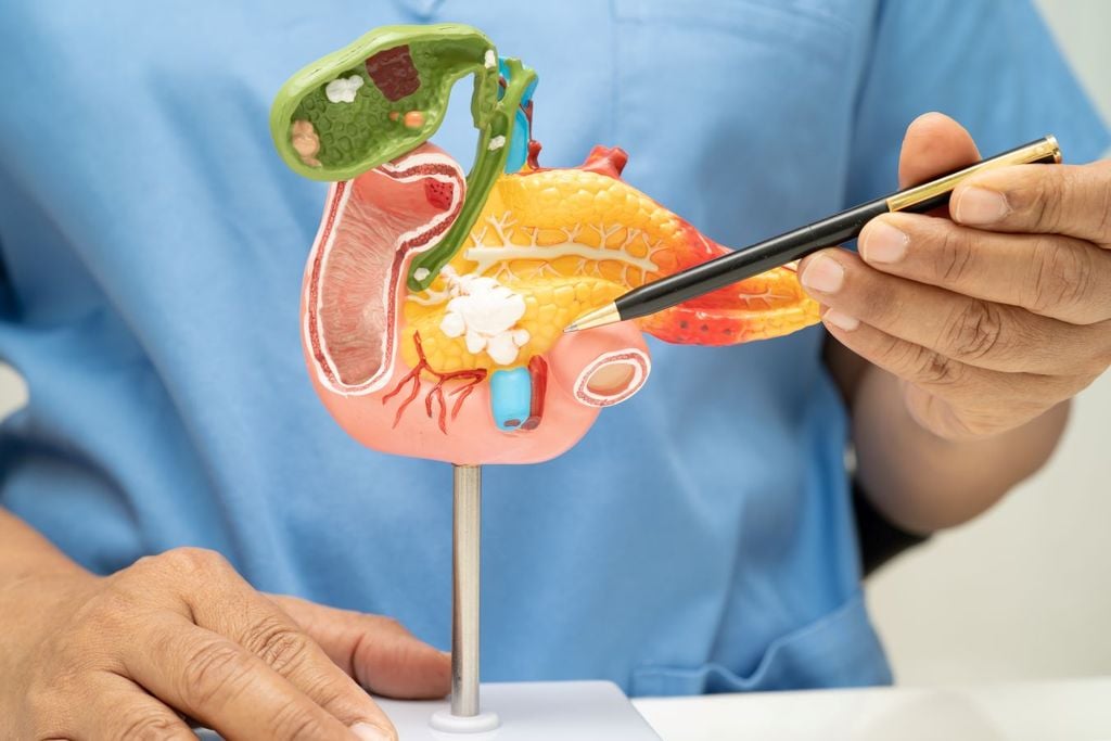 A partir del año 2030 el cáncer de páncreas llegará a ser la segunda causa de muerte por cáncer en el mundo.