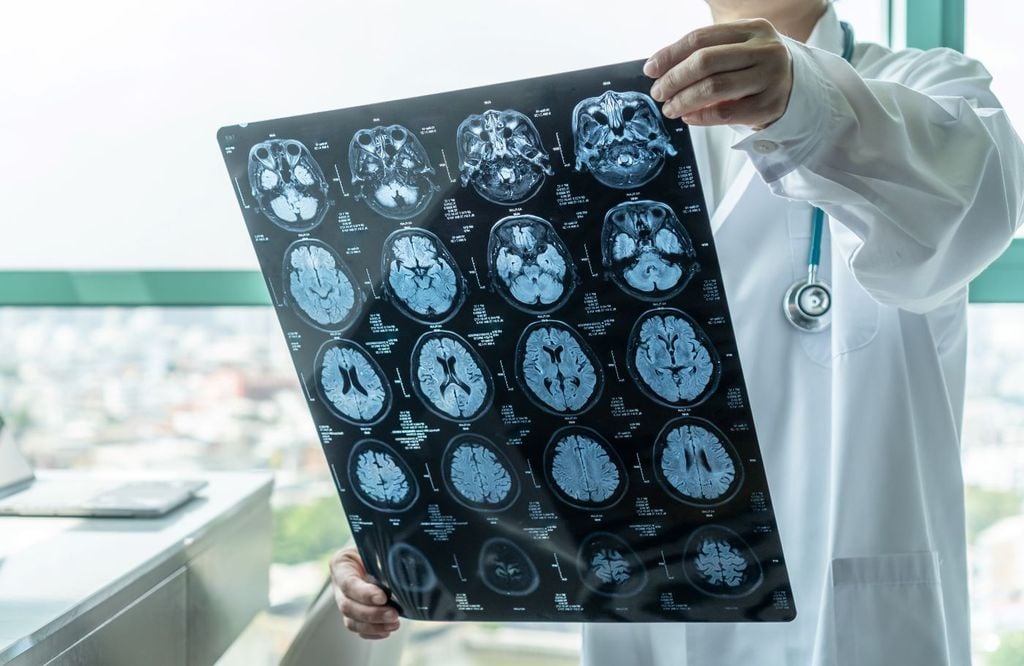 Con estos hallazgos se cuenta con una mayor comprensión de cómo aprende el cerebro. Con estos hallazgos se cuenta con una mayor comprensión de cómo aprende el cerebro.