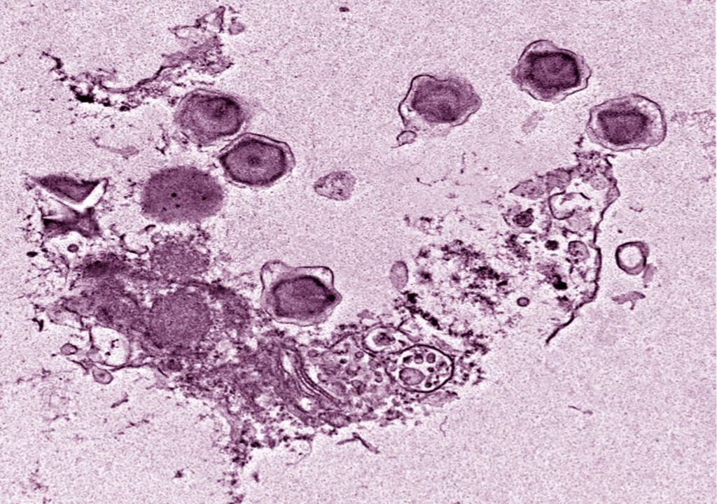 Virus gigantes Virus gigantes