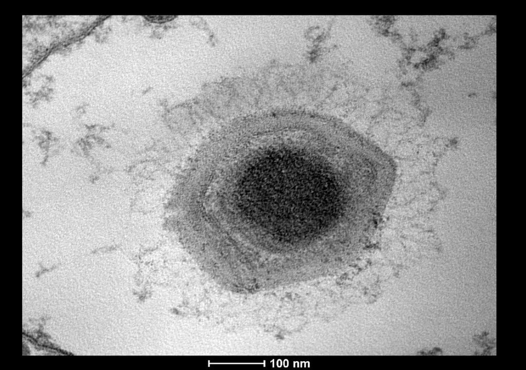 Virus gigante Virus gigante