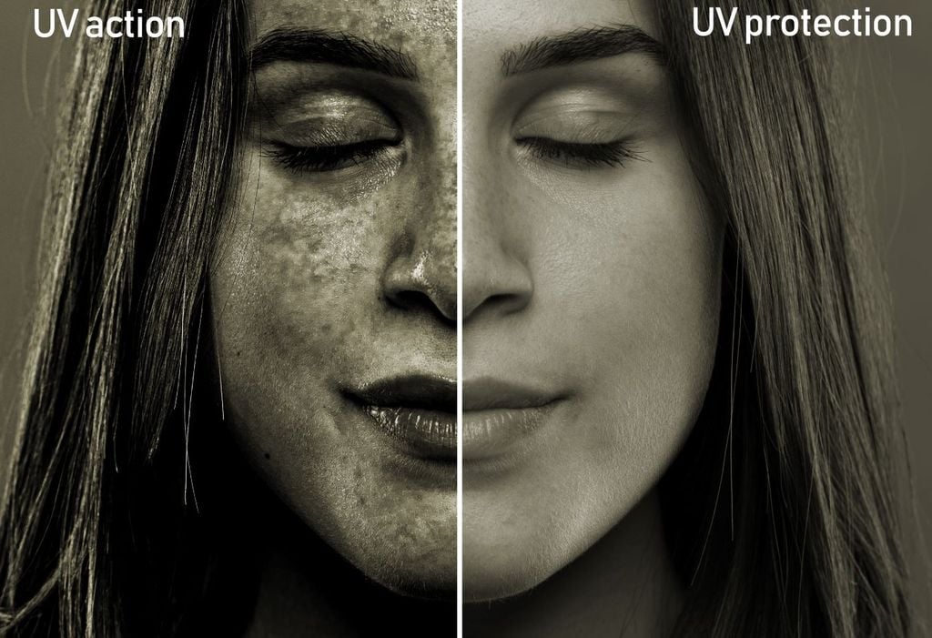 Experten warnen, dass UV-Strahlen eine der Ursachen für Melanome sind