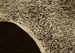 Die Zukunft gesunder Knochen – aktuelle Forschung zur stillen Gefahr Osteoporose