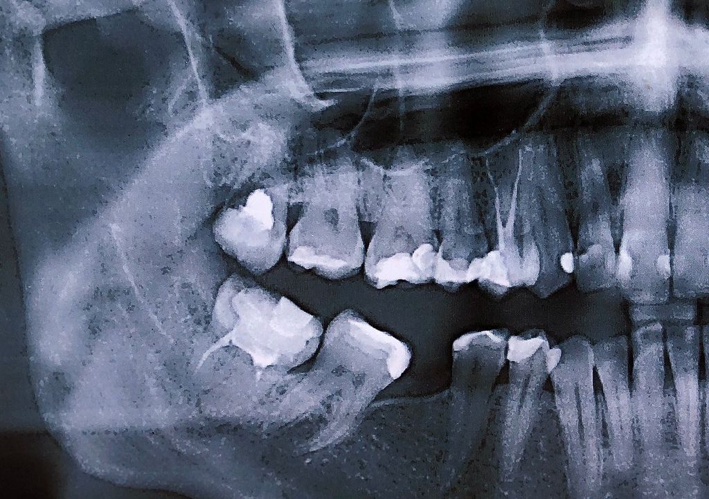 dental, dientes, medicina