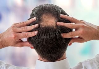 They Discover a Molecule that Makes Hair Grow, Can We Say Goodbye to Baldness?