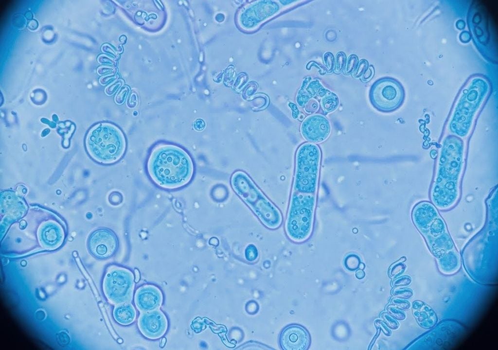 Per circa 3 miliardi di anni, batteri e archei hanno dominato l'intero ecosistema senza mostrare alcuna spinta verso il pluricellularismo.