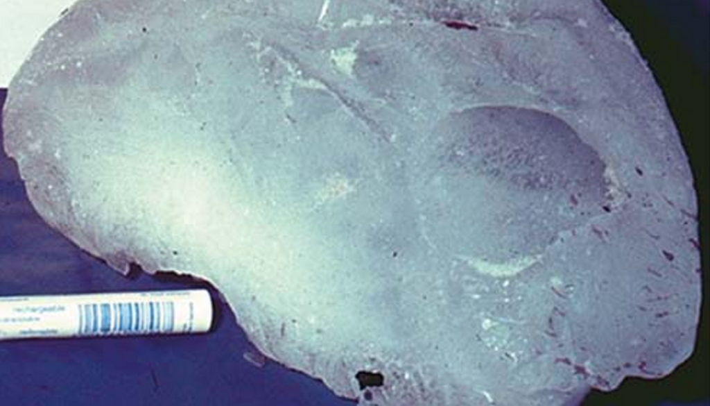 Eines der Fragmente des Megakryometeors, der im spanischen San Felice de Lena, Asturien, am 26. Januar 2000 niederging. Bild: J. Martinez-Frias & A. Delgado Huertas (2006): Megacryometeors: Distribution on Earth and Current Research. Eines der Fragmente des Megakryometeors, der im spanischen San Felice de Lena, Asturien, am 26. Januar 2000 niederging. Bild: J. Martinez-Frias & A. Delgado Huertas (2006): Megacryometeors: Distribution on Earth and Current Research. Ambio, 35, 6, S. 315