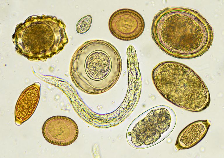 microorganismos intestinales microorganismos intestinales