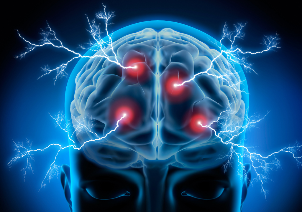 Cerebro Cerebro