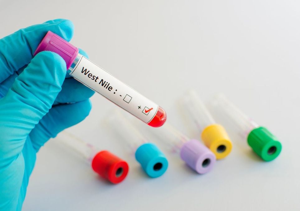 Pruebas virus del Nilo Occidental