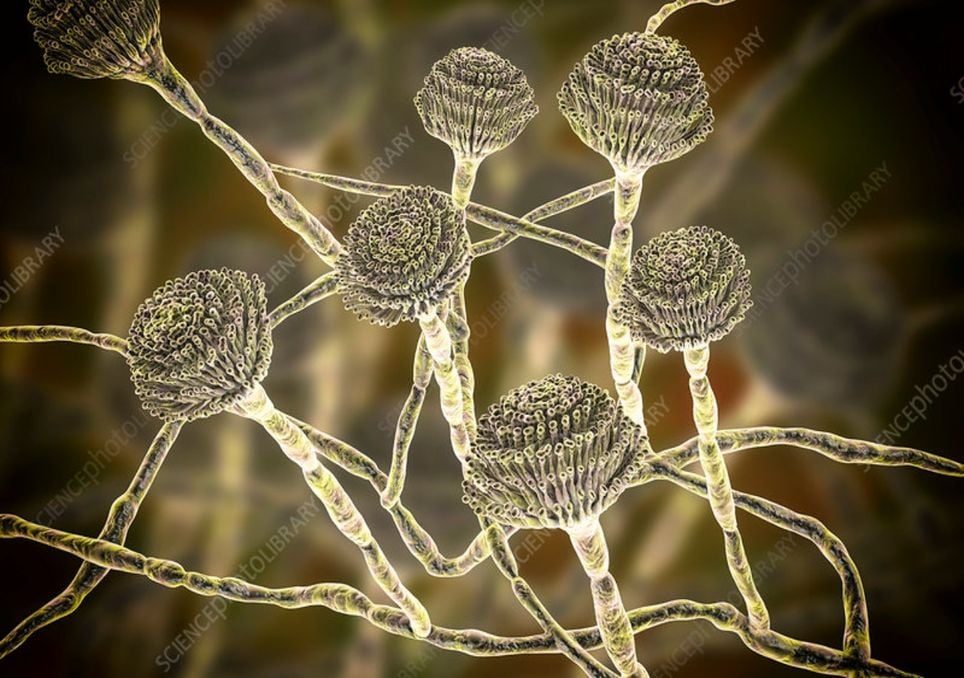 El hongo invisible que amenaza con devorarnos desde dentro: la expansión silenciosa del Aspergillus. Noticias en tiempo real