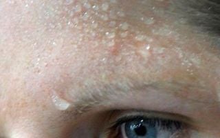 El índice o sensación térmica de calor: impacto en la salud