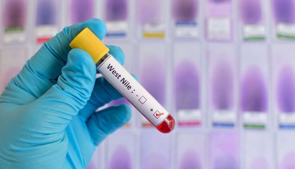 Virus del Nilo Entre el 70% y el 80% de las personas infectadas nunca desarrolla síntomas