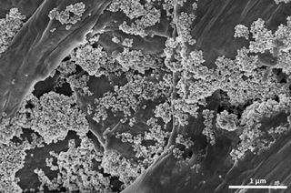 Consiguen eliminar los dañinos microplásticos del agua con "nanoflores"
