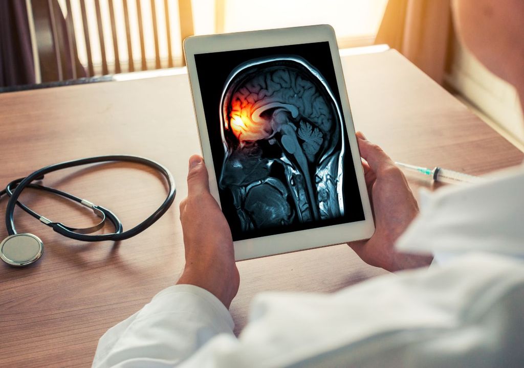 Síntomas de la meningitis