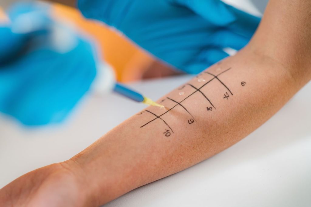 Test para identificar el tipo de alergia que se tiene, el alergólogo es el indicado para realizar el diagnóstico