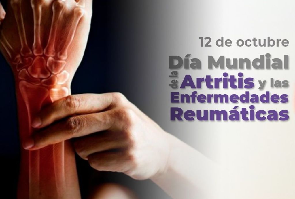 Existen más de 200 enfermedades reumáticas.