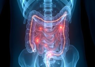 Equipa portuguesa descobre acidentalmente bact&eacute;ria que trava infe&ccedil;&otilde;es no intestino