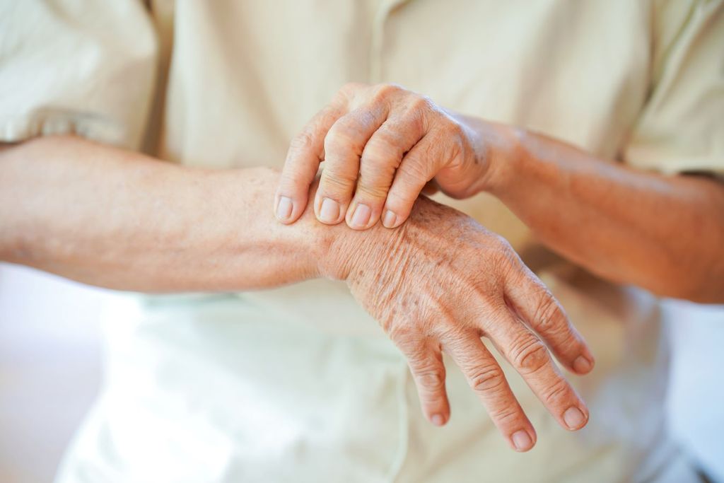 La artritis reumatoide es una de las enfermedades reumáticas más comunes