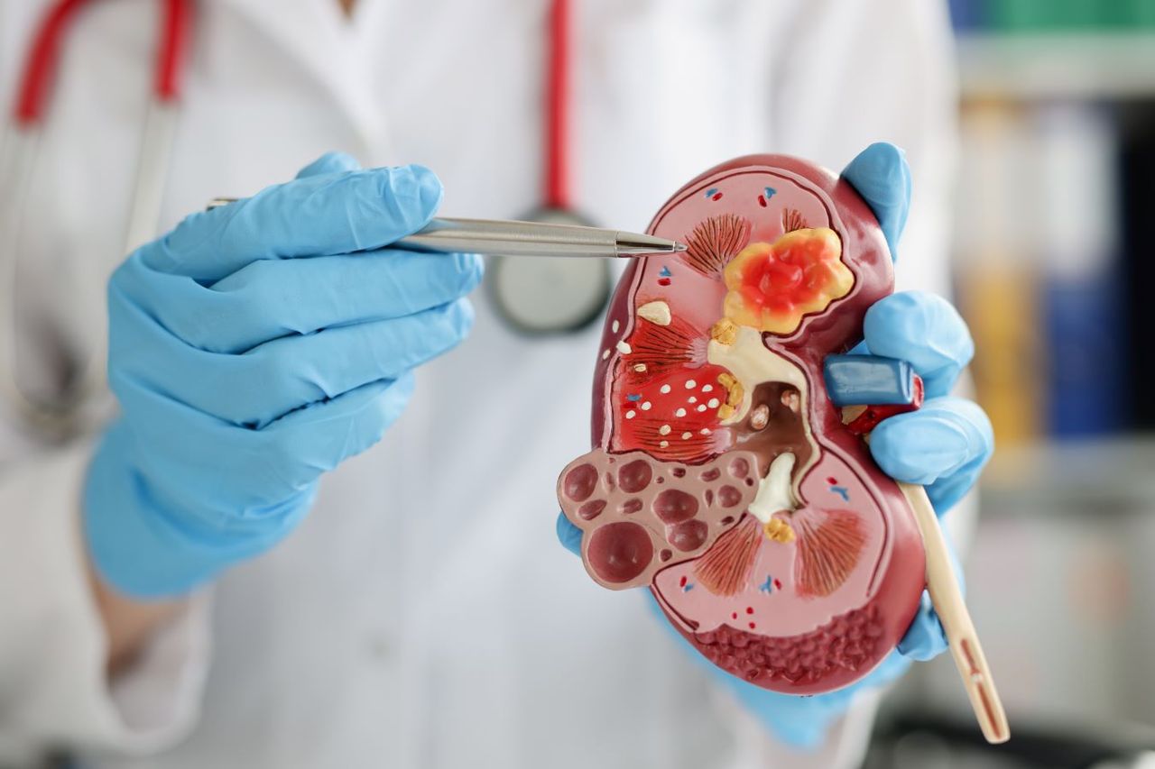 14 de marzo Día Mundial del Riñón, todos por la salud renal